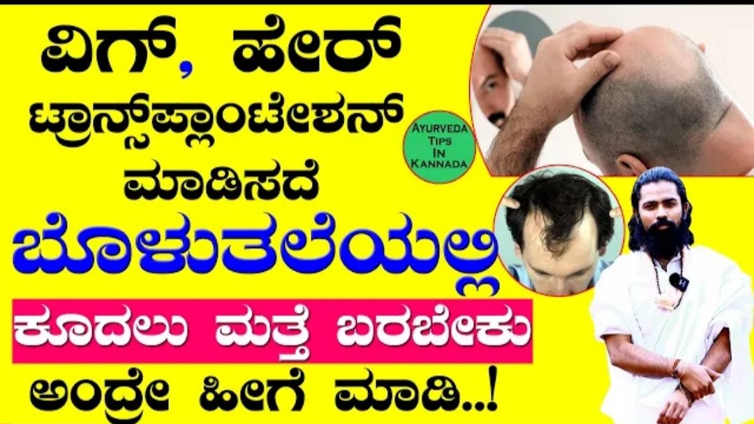 ಬೋಳು ತಲೆಯಲ್ಲಿ ಕೂದಲು ಮತ್ತೆ ಬರಬೇಕು ಅಂದ್ರೆ ಹೀಗೆ ಮಾಡಿ ಖಂಡಿತವಾಗಿಯೂ ಆಶ್ಚರ್ಯ ಪಡುತ್ತೀರಾ.